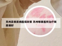 苏州高银屑病医保政策 苏州哪里医院治疗银屑病好