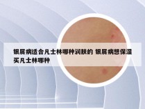 银屑病适合凡士林哪种润肤的 银屑病想保湿买凡士林哪种
