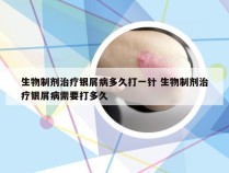 生物制剂治疗银屑病多久打一针 生物制剂治疗银屑病需要打多久