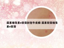尿素维生素e软膏封包牛皮癣 尿素软膏维生素e软膏
