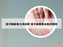 孩子胸前有几块白斑 孩子前胸有白色的斑块