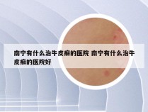 南宁有什么治牛皮癣的医院 南宁有什么治牛皮癣的医院好