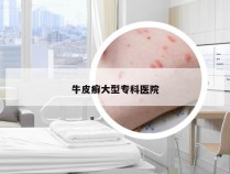牛皮癣大型专科医院
