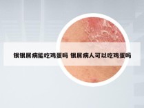 银银屑病能吃鸡蛋吗 银屑病人可以吃鸡蛋吗