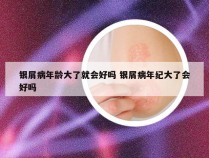 银屑病年龄大了就会好吗 银屑病年纪大了会好吗