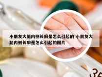 小朋友大腿内侧长癣是怎么引起的 小朋友大腿内侧长癣是怎么引起的图片