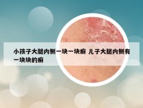 小孩子大腿内侧一块一块癣 儿子大腿内侧有一块块的癣