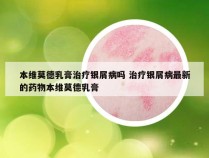 本维莫德乳膏治疗银屑病吗 治疗银屑病最新的药物本维莫德乳膏