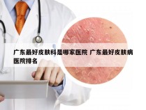 广东最好皮肤科是哪家医院 广东最好皮肤病医院排名
