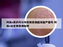 阿维a真的可以导致银屑病越来越严重吗 阿维a治愈银屑病贴吧
