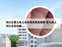 为什么婴儿身上会无缘无故出现癣 婴儿身上为什么会长癣