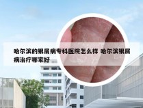 哈尔滨的银屑病专科医院怎么样 哈尔滨银屑病治疗哪家好