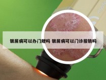 银屑病可以办门规吗 银屑病可以门诊报销吗