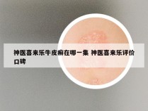 神医喜来乐牛皮癣在哪一集 神医喜来乐评价口碑