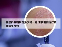 皮肤科生物制剂多少钱一针 生物制剂治疗皮肤病多少钱