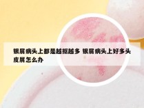 银屑病头上都是越抠越多 银屑病头上好多头皮屑怎么办