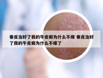 秦皮治好了我的牛皮癣为什么不痒 秦皮治好了我的牛皮癣为什么不痒了
