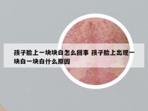 孩子脸上一块块白怎么回事 孩子脸上出现一块白一块白什么原因