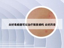 众好毒癣康可以治疗银屑病吗 众好药膏