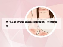 吃什么蔬菜对银屑病好 银屑病吃什么菜有营养