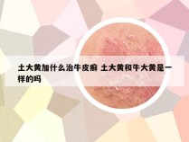 土大黄加什么治牛皮癣 土大黄和牛大黄是一样的吗