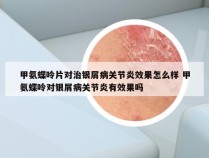 甲氨蝶呤片对治银屑病关节炎效果怎么样 甲氨蝶呤对银屑病关节炎有效果吗