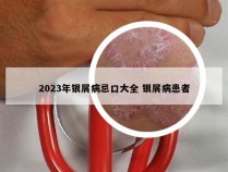 2023年银屑病忌口大全 银屑病患者
