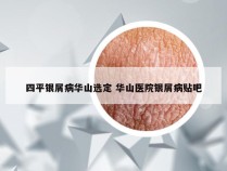 四平银屑病华山选定 华山医院银屑病贴吧