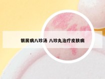 银屑病八珍汤 八珍丸治疗皮肤病