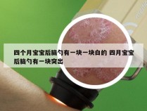 四个月宝宝后脑勺有一块一块白的 四月宝宝后脑勺有一块突出