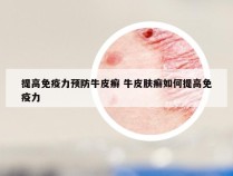 提高免疫力预防牛皮癣 牛皮肤癣如何提高免疫力