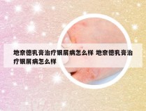 地奈德乳膏治疗银屑病怎么样 地奈德乳膏治疗银屑病怎么样