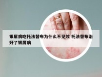 银屑病吃托法替布为什么不见效 托法替布治好了银屑病