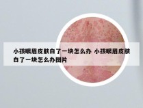 小孩眼眉皮肤白了一块怎么办 小孩眼眉皮肤白了一块怎么办图片