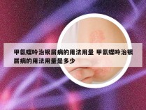 甲氨蝶呤治银屑病的用法用量 甲氨蝶呤治银屑病的用法用量是多少