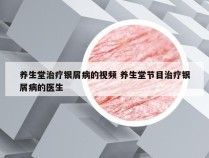 养生堂治疗银屑病的视频 养生堂节目治疗银屑病的医生