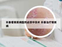 长春看银屑病医院必到中技术 长春治疗银屑病