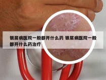 银屑病医院一般都开什么药 银屑病医院一般都开什么药治疗