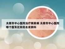 太原市中心医院治疗银屑病 太原市中心医院哪个医生比较出名皮肤科