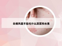 白癜风最不能吃什么蔬菜和水果