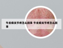 牛皮癣关节疼怎么回事 牛皮癣关节疼怎么回事