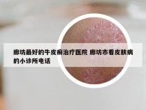 廊坊最好的牛皮癣治疗医院 廊坊市看皮肤病的小诊所电话