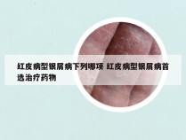 红皮病型银屑病下列哪项 红皮病型银屑病首选治疗药物