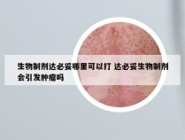 生物制剂达必妥哪里可以打 达必妥生物制剂会引发肿瘤吗