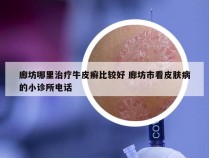 廊坊哪里治疗牛皮癣比较好 廊坊市看皮肤病的小诊所电话