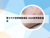 第十六个世界银屑病日 2020世界银屑病日