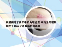 银屑病吃了两年中药为啥还发 中药治疗银屑病吃了16天了还有新的张出来