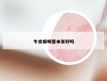 牛皮癣喝薏米茶好吗