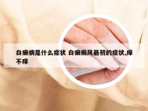 白癞病是什么症状 白癞癜风最初的症状,痒不痒