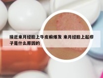 接近来月经脸上牛皮癣爆发 来月经脸上起疹子是什么原因的